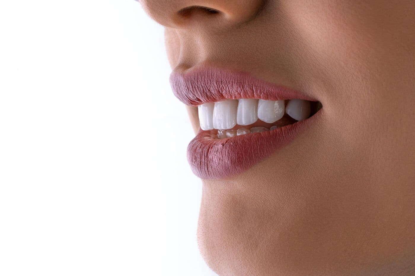 A close-up of a smile in profile against a white background